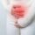 What Is Cervical Insufficiency in Pregnancy?
